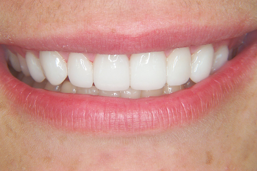 Case Study 10 After