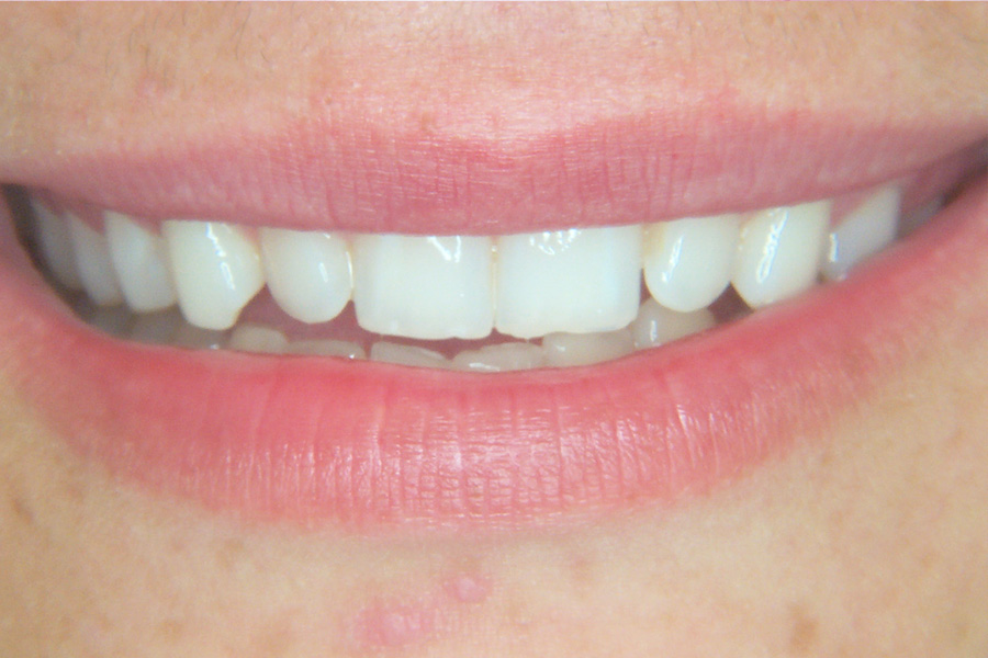Case Study 10 After