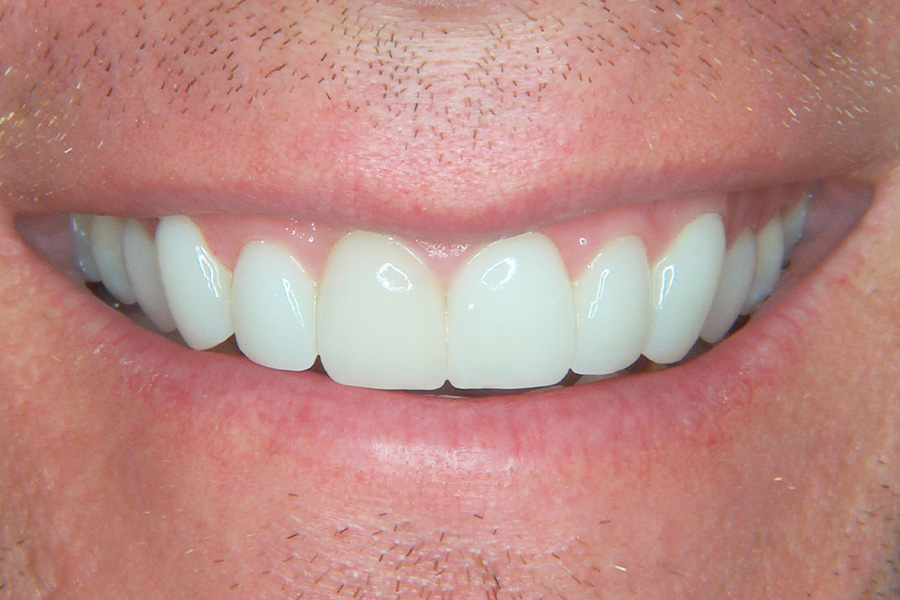 Case Study 11 After