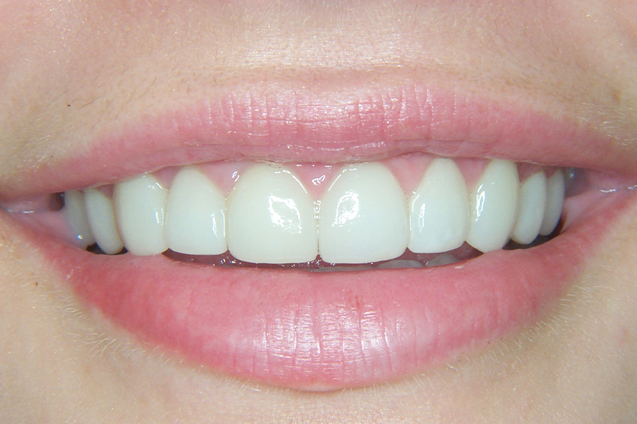 Case Study 12 After
