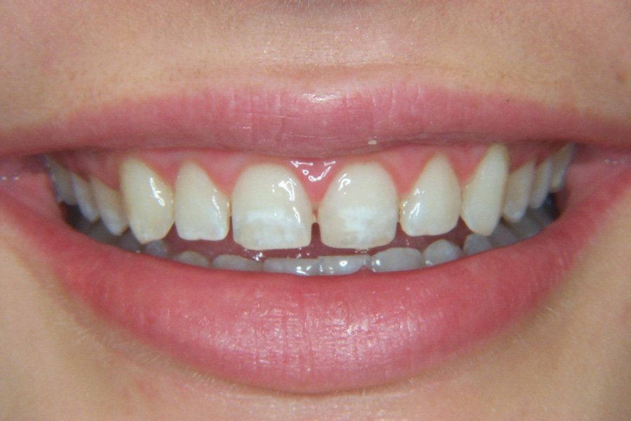 Case Study 12 Before