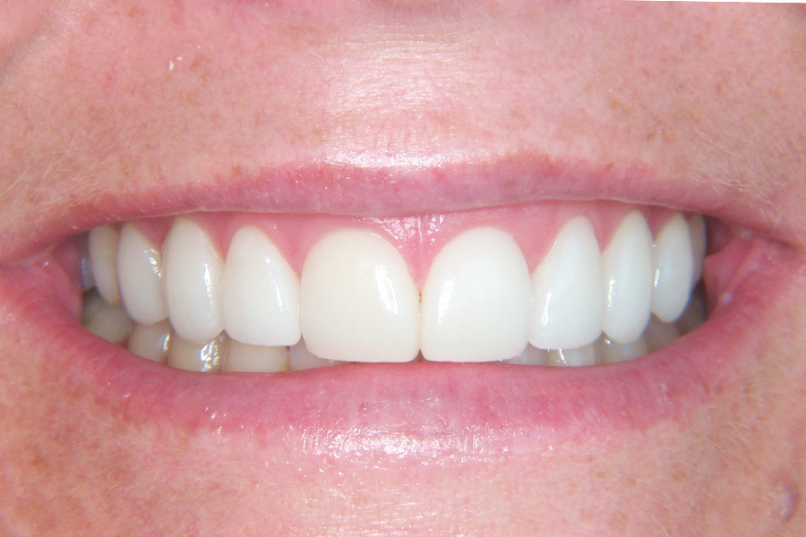 Case Study 13 After
