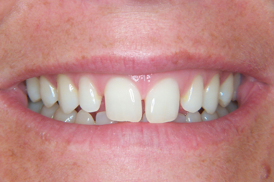 Case Study 13 Before