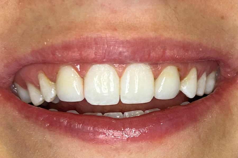 Case Study 14 After