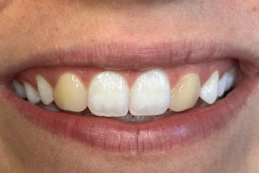 Case Study 14 Before
