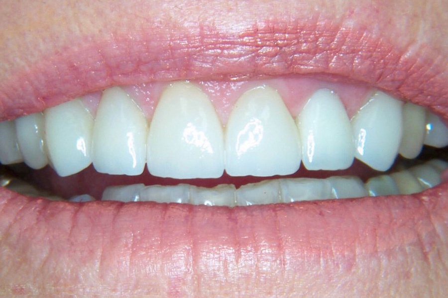 Case Study 5 After