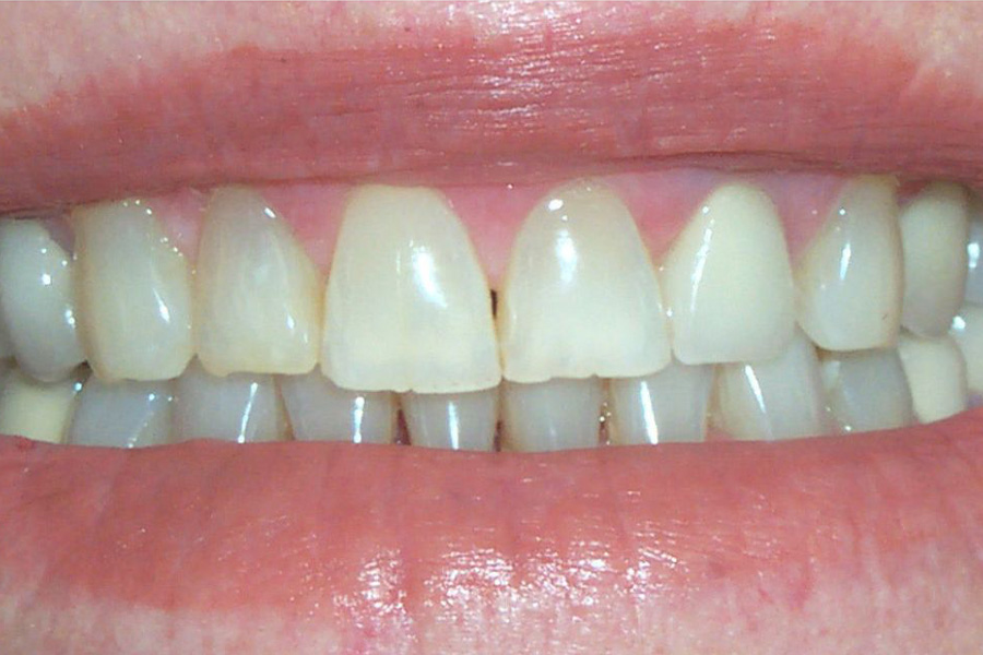 Case Study 5 Before