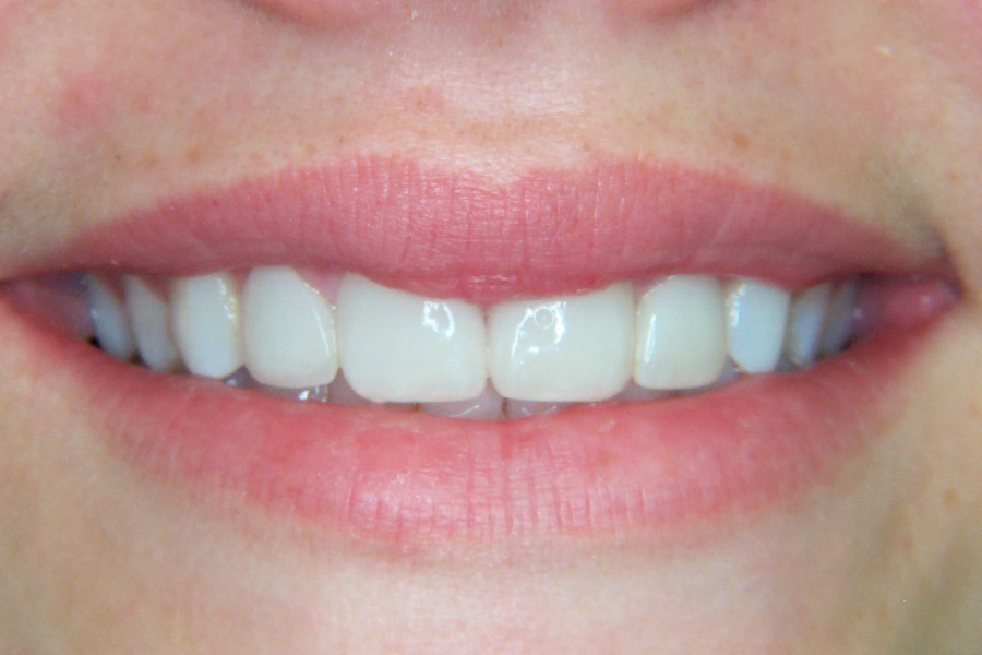 Case Study 6 After
