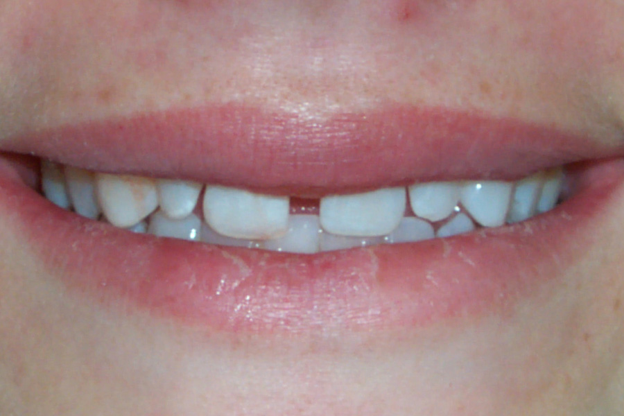 Case Study 6 Before