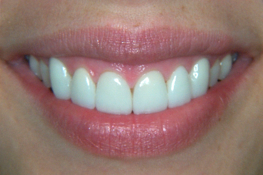 Case Study 7 After