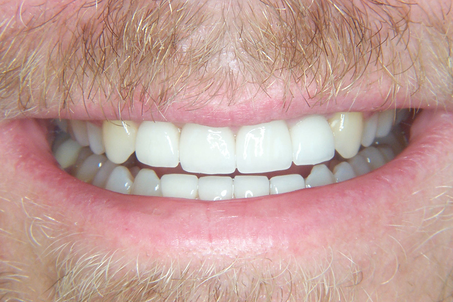 Case Study 8 After
