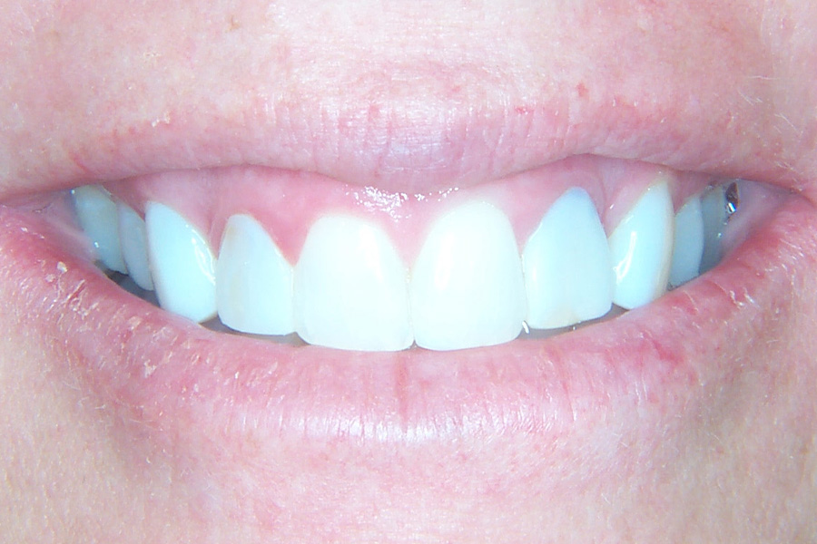 Case Study 9 After