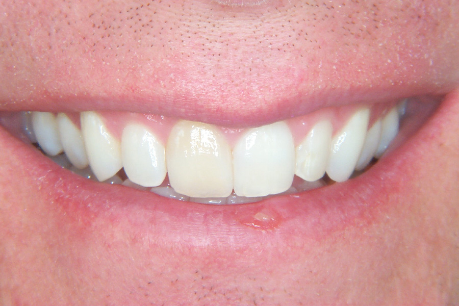 Case Study 9 Before